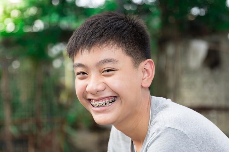 A teenage boy smiling with braces on his teeth after an orthodontic appointment